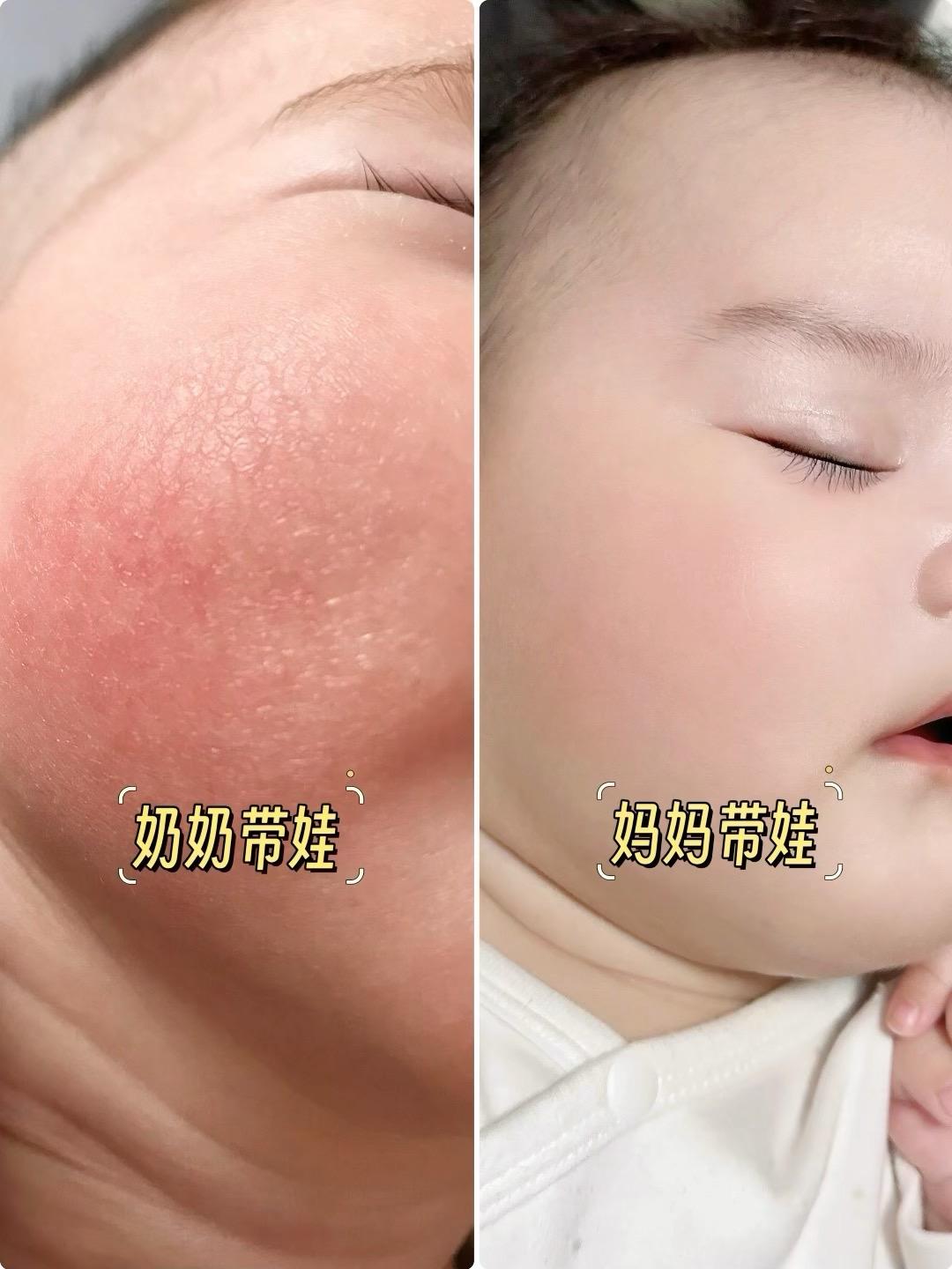 换季时宝宝小脸容易闹脾气?试试#兔头妈妈 #儿童面霜 专为宝宝研发,温和配方,滋润保湿又好吸收,这个秋冬有它就安心啦~#宝宝面霜 #换季护肤#母婴好物