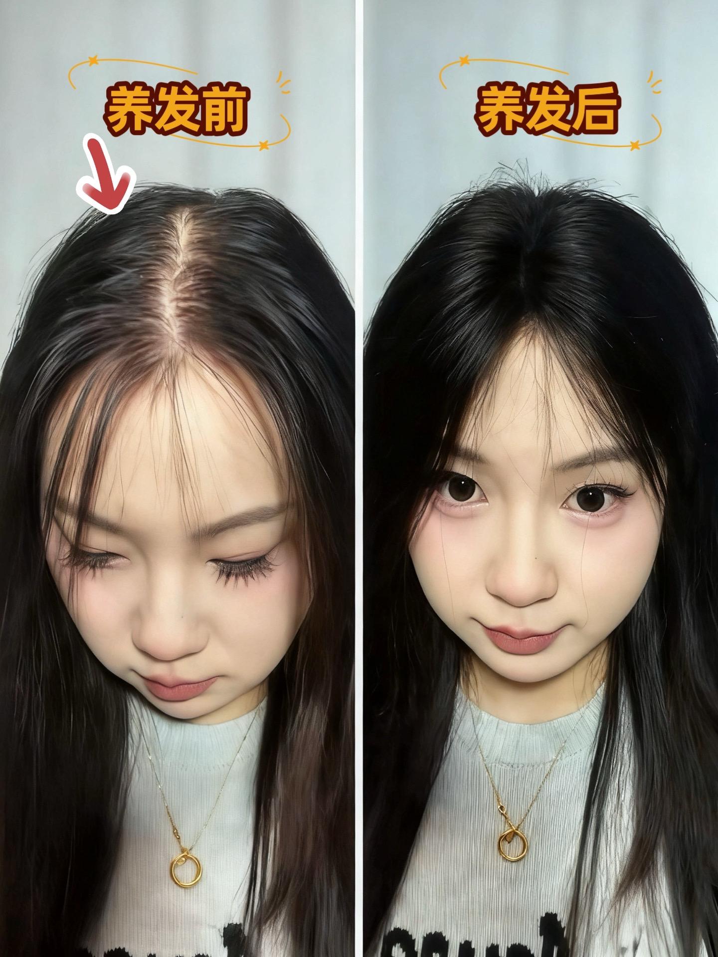 拍一发二瓶,全家都可以用,真是既平价又好用,赶紧囤起来吧#好用洗发水 #养发 #瑶品 #防脱洗发水#脱发怎么办