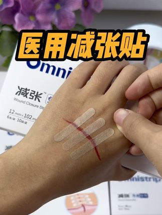 黑怕疤痕变大变丑的朋友,你就选这款奥嘉莱减张贴,真的有效果#医用勉缝胶带#医用减张贴