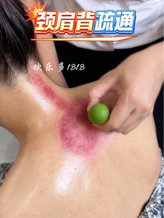 #肩颈疏通 #按摩放松 #背部训练 #小动作大作用 #好物推荐🔥