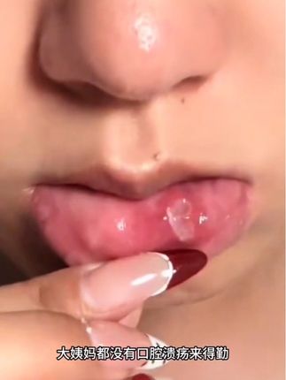嘴巴里反复白点点的 一定要试试这个泰国口腔膏,不贵好使!#强烈推荐 #内容太过真实 #分享生活小技巧