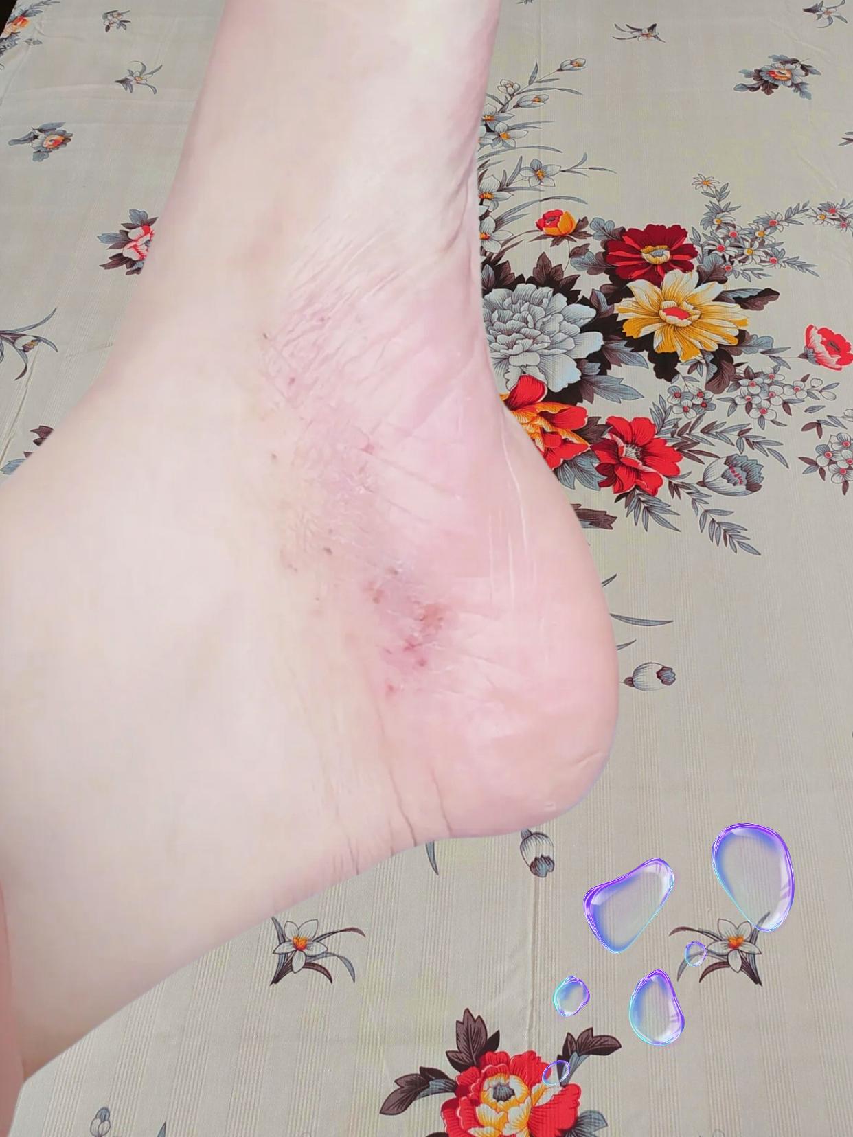 轻舟已过万重山#脚 #太不容易了 #足部护理#我的脚脚