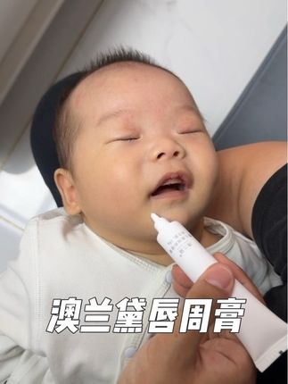 家里有爱流口水的宝宝一定要准备这个澳兰黛的唇周膏哦#澳兰黛唇周膏 #唇周膏 #唇周膏推荐 #好物推荐🔥 #好物分享🔥