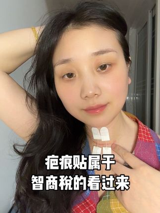 甲状腺术后72天疤痕改善情况