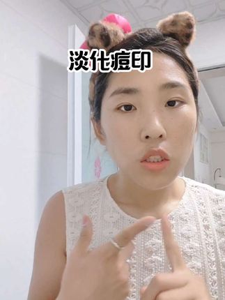回复 @小庆的评论 #痘印 #淡痘印