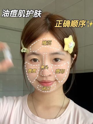 祛痘不走弯路‼️油痘肌正确的护肤方式来啦~#祛痘 #痘痘 #痘痘肌 #鲜一祛痘套装 #鲜一祛痘