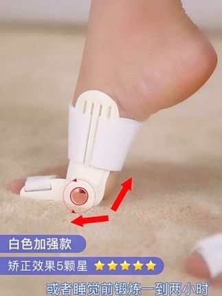 #拇指外翻矫正器 #拇指外翻矫正 #脚趾矫正 #拇指外翻分趾器 #拇指外翻怎么办 大拇外翻矫正器脚趾外翻矫正垫成人内翻大脚骨足外翻脚趾重叠矫正