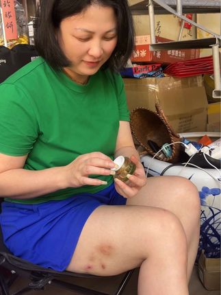 苏立池抑菌膏