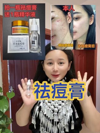 姐妹们对付各种痘,这个老款祛痘膏是认真的#自用好物分享 #好物推荐🔥 #祛痘膏 #祛痘 #超级便宜划算