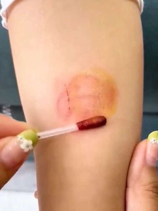 一次性碘伏消毒液家用护理棉签棉棒独立包装便捷户外登山应急护理#居家好物  #家用好物 #碘伏棉签 #碘伏消毒棉签 #男士神仙单品