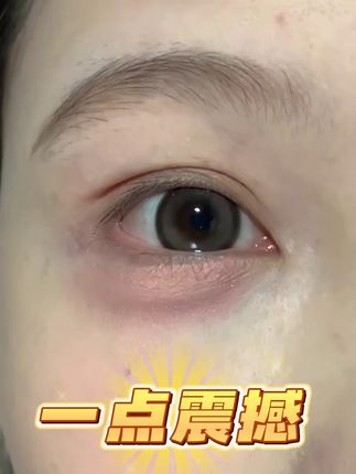 这次谁还敢当众扯下我的双眼皮贴 姐妹们!这个东西真的太好用了!!!~ #双眼皮贴 #双眼皮贴推荐 #隐形双眼皮贴 #素肌双眼皮贴 