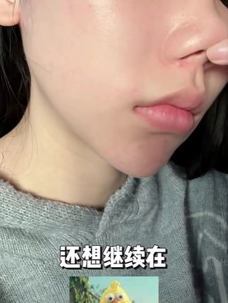 阴雨天 + 熬夜 = 痘痘大爆发?nonono!👉🏻👈 #好物推荐🔥 #星星痘痘贴 #护肤 #好物推荐 #仙女必备 黄蓝痘痘贴带着茶树精油 + 水杨酸双 buff 来救场啦~贴上去凉凉的超舒服,像给痘痘盖了个 “隔离监狱”,既能消炎又能吸脏东西,第二天醒来痘痘就怂了!现在它已经是我床头常驻嘉宾,痘肌宝子们都给我囤!🛒