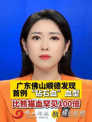 广东佛山顺德发现首例“钻石血”血型 比熊猫血罕见100倍。(出镜:刘畅 ;实习编辑:黄晓薇;主编:梅雪妍;责编:崔锦玥;素材来源:佛山新闻)#钻石血 #熊猫血 #顺德 #热点
