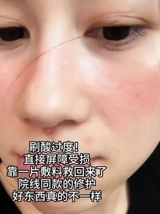 #舒缓修护面膜 #晒后修复 #医美 #术后护理 #面膜