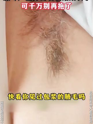 超爱的一款腋露推荐给所有宝宝们!汗多汗黄味道大,统统都可以用它!