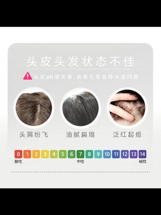施巴洗发水,德国品质去屑强 施巴洗发水 宝子们,有头屑问题的可别错过这款施巴去屑养护洗发水。它来自德国,品质有保障。能有效清洁头皮,控油去屑,男女通用哟。400ml的大容量,能用很久。用它洗头,让你的头皮保持清爽干净,头发更加健康啦。#施巴洗发水 #去屑养护 #德国洗头液 #清洁头皮 #控油洗发水