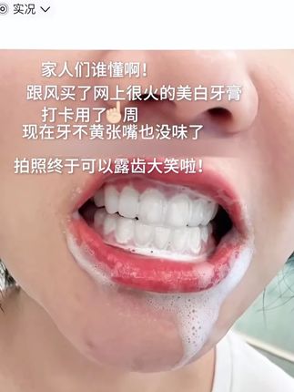 牙黄!嘴巴有异味!怎么办?那就试试这个好用的#牙膏 用完香香,涂啥口红都好看#护牙 #好物推荐