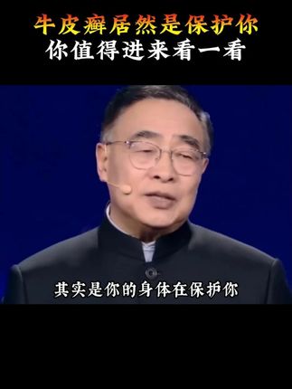 #健康科普#身体健康#好物推荐#银屑病