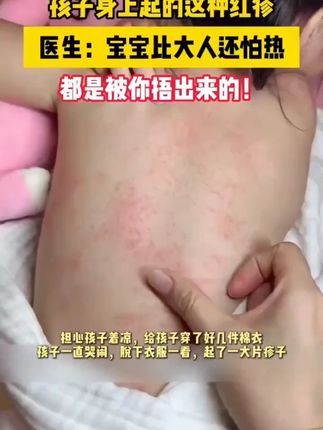 #宝宝热疹护理 #夏日清爽 #温和祛痒 #洗澡后必备 #母婴好物分享