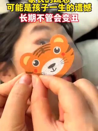 家长们一定不要疏忽,可能是孩子的遗憾一定要注意⚠️#张嘴呼吸会变丑 #闭嘴贴矫正呼吸神器