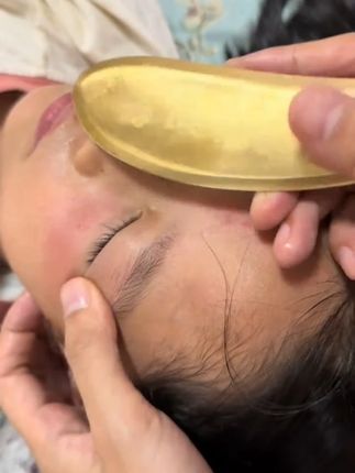 现在孩子电子产品用太多了,家长可以在家给孩子护理,挂完去望远,会明显改善。