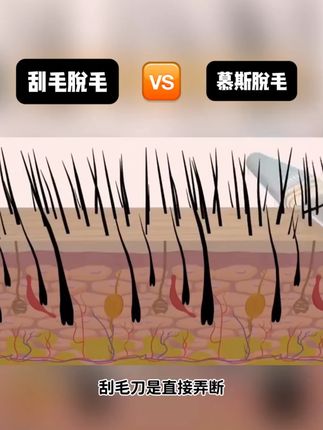 这个脱毛慕斯真的疯狂安利很多次了!真的很好用!#脱毛#脱毛膏#脱毛好物分享 #脱毛膏推荐#种草好物