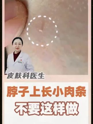 #私密护理天花板 #皮肤管理 #皮肤护理 #小肉条护理膏 #小肉粒护理膏