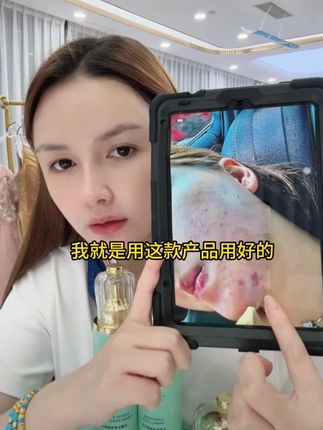 婷婷以前的烂脸肌肤就是用这款抗皱水乳霜好的 #好皮肤养出来 #婷婷不停 #抗皱紧致 #抗皱嫩肤 #水乳套装