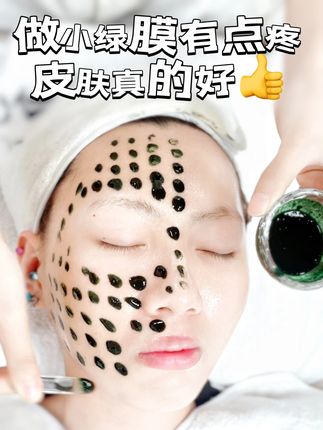 #护肤分享 加强版海绵微晶#小绿膜 刺感强,但结果很好,搭配舒缓凝胶和冻干粉,补水修护一步到位!#坚持护肤 #海绵微针 #皮肤管理