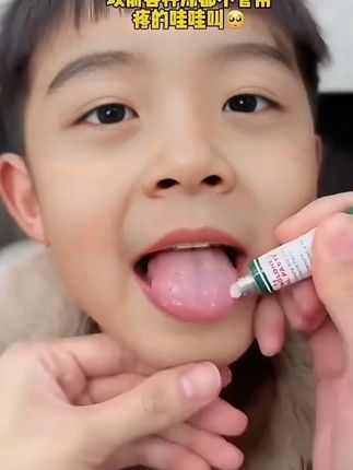 【好物推荐】泰国口腔膏有很多,重要的是选对的,用好的。#平价好物 #好物推荐🔥 #嘴巴 #口腔护理