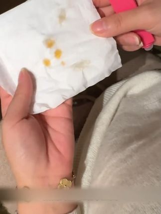去渍笔