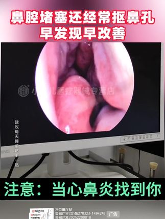 鼻炎、鼻窦炎、鼻甲肿胀、打喷嚏过敏性鼻炎都是可以用【北京同仁堂鼻炎贴】#鼻炎 #鼻炎贴 #鼻炎鼻窦炎 #过敏性鼻炎