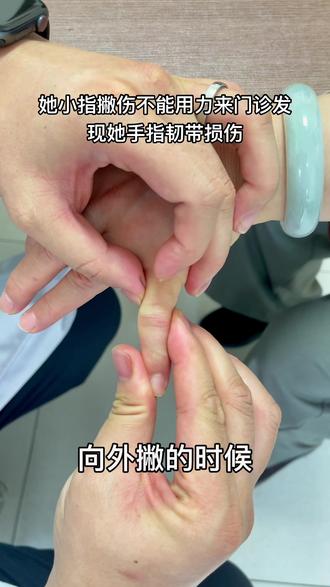 医学科普#手指伸不直#手指弯不了#肌腱断裂#肌腱粘连@aico