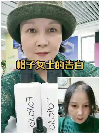 超级感人的视频反馈
花了15000都没长出头发
密思丝密几个月浓密不少
好用又有效的洗发水
真的可遇不可求