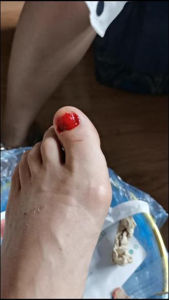 看看我的脚大拇指像不像涂了指甲油