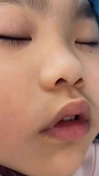 张着嘴巴睡觉真的会变丑张嘴睡觉会变丑