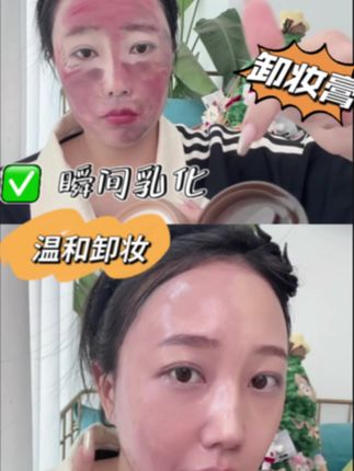 能轻松卸除防水彩妆,质地就像冰淇淋,沾水乳化快,亲肤且温和卸妆,敏感肌也能放心用哦#分享爱用物 #温和不刺激卸妆 #卸妆膏推荐 #柳丝木卸妆膏