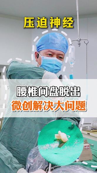 腰椎间盘脱出,微创解决大问题
#腰突 #腰椎间盘突出 #脊柱内镜 #抖出健康知识宝藏 #我的年度健康科普