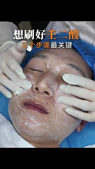壬二酸想刷好,刷透,记住3个关键
#刷酸 #刷酸教程 #刷酸课程 #刷酸培训 #艾肤学苑