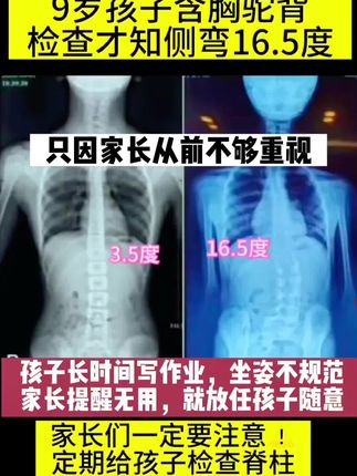 每天睡前让孩子坚持做拉伸,好处多多,大人也可以跟着一起练拉伸#有助于孩子长高的方法 #抑制骨骺线闭合的方法