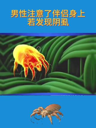 元南本草百部酊#虱子 #虱子卵 #头虱 #虱子是怎么来的 #虱子克星