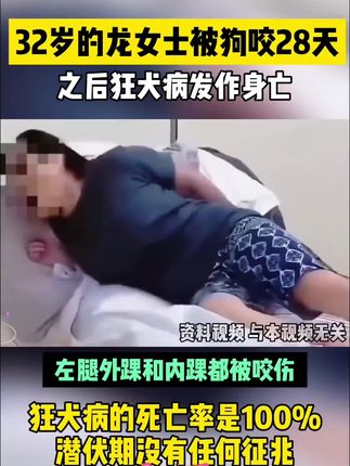 #科学养宠攻略 #新手养猫#狂犬病#猫猫