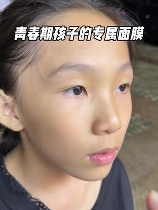 终于有青少年专用的#祛痘面膜 了!多重植萃无酸配方!温和祛痘,控油淡化痘印,不想开学还满脸痘痘闭口的!赶紧用起来!#袋鼠妈妈祛痘面膜 #青少年祛痘面膜 #油痘肌护肤 #青春期长痘怎么办..