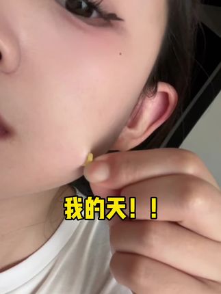 真的怪不得那些明星博主都在贴星星痘痘贴!!真的是又好看又能吸!!#痘痘贴 #油痘肌 #长痘 #超便宜超划算