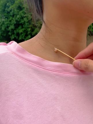 #脖子上的小肉粒是什么 #点痣点斑
