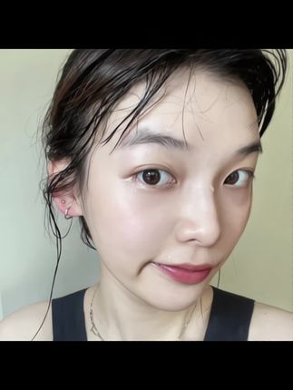 幸好听了妈妈的话…每晚贴一贴,困顿油腻豆豆都在消失了