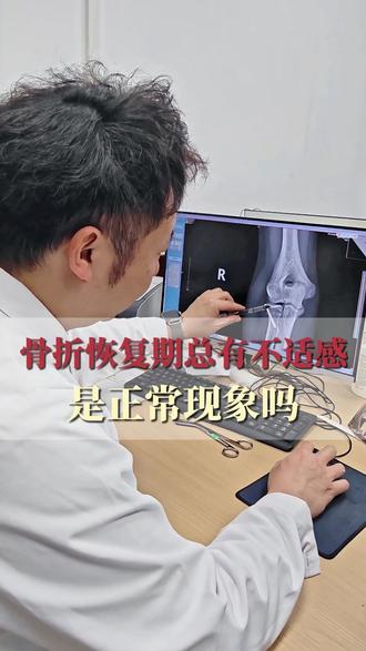 骨折恢复期总有不适感是正常的吗?
患者骨折术后六个月复查,整体恢复很好,有点不适感很正常,会随着时间慢慢恢复~#骨折#骨科#医学科普#医生日常#门诊日常