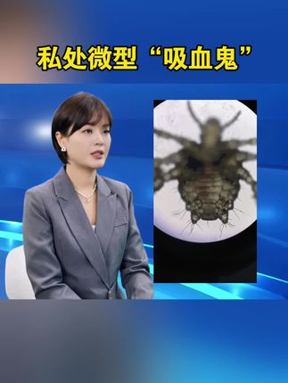 私处吸血鬼阴虱 【保密发货】男女阴虱,儿童头虱,成分温和 #阴虱 #阴虱喷雾剂 #虱子 #仁和复方百部酊喷剂