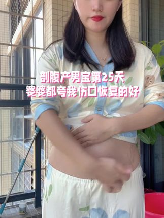 剖腹产后,🧑⚕️叮嘱要注意清洁,7天后就可以洗澡了,但是避免伤口感染最好贴上防水贴,我一直到现在都还在用,保护的很好,剖腹产后做好防水很重要‼️#产后恢复 #待产包 #待产包必备