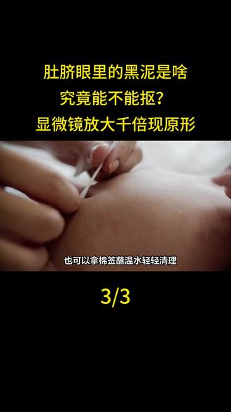 肚脐眼里的黑泥是啥,究竟能不能抠?显微镜放大千倍现原形